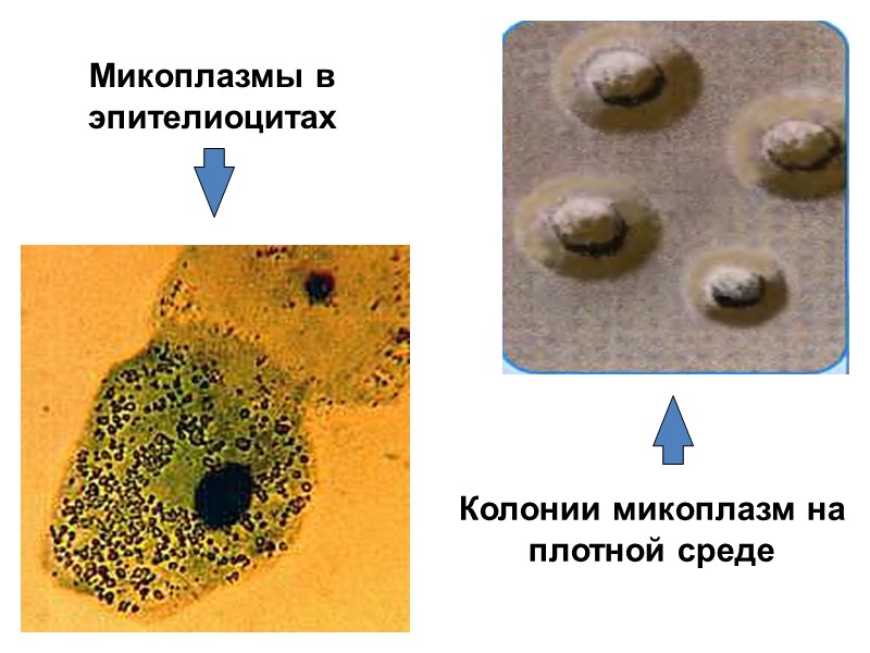 Микоплазмы в эпителиоцитах Колонии микоплазм на плотной среде